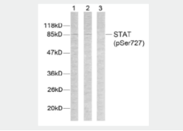 Anti-STAT3 (phospho S727)抗体.png