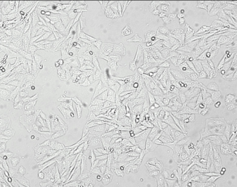 saos2骨肉瘤细胞膜复合纳米脂质体