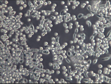 MKN-45胃癌细胞膜修饰纳米囊泡