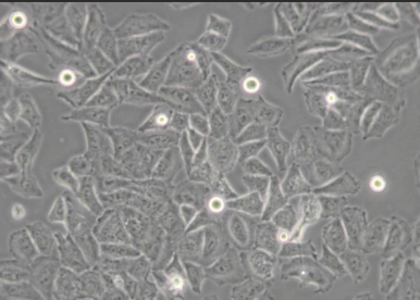 HL-7702正常肝细胞膜复合纳米脂质体
