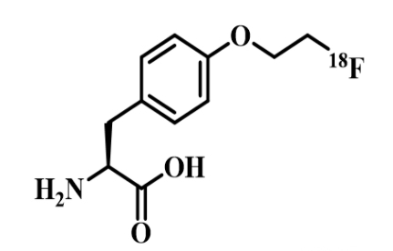 11C-MET分子探针|11C-甲基-L-蛋氨酸|分子靶点:氨基酸类 11C-MET分子探针|11C-甲基-L-蛋氨酸|分子靶点:氨基酸类