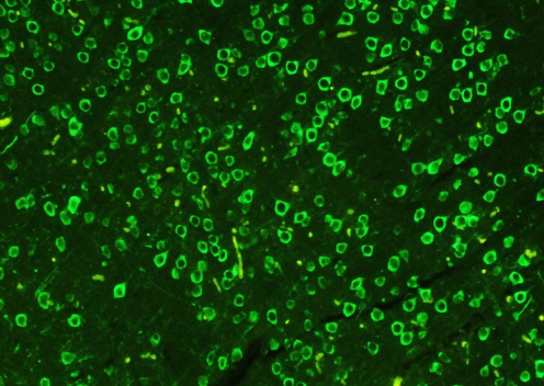 荧光素FITC-Human fibrinogen 绿色荧光素标记人血纤维蛋白原的应用