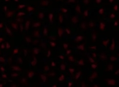 荧光修饰响应型造影脂质体定制技术（Fluorescently Labeled Stimuli-Responsive Imaging Liposome Customization Technology）