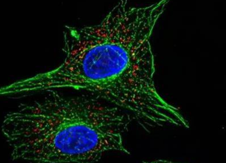 Gd修饰载药脂质体定制技术 Gd-Functionalized Drug-Loaded Liposome Customization